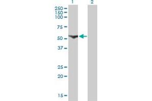 Western Blotting (WB) image for anti-Cytidine and DCMP Deaminase Domain Containing 1 (CDADC1) (AA 423-515) antibody (ABIN466247) (CDADC1 anticorps  (AA 423-515))