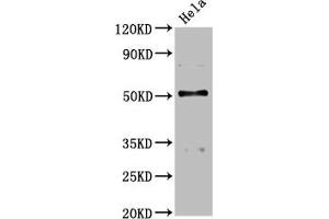 Western Blot Positive WB detected in: Hela whole cell lysate All lanes: BCKDHA antibody at 4. (BCKDHA anticorps  (AA 268-407))