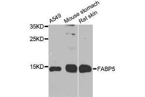 Western blot analysis of extracts of various cell lines, using FABP5 antibody. (FABP5 anticorps)