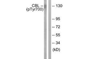 Western blot analysis of extracts from K562 cells treated with Na3VO4 0.