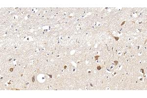 Detection of IL17RA in Human Cerebrum Tissue using Polyclonal Antibody to Interleukin 17 Receptor A (IL17RA) (IL17RA anticorps  (AA 33-172))