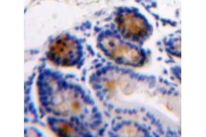 Used in DAB staining on fromalin fixed paraffin-embedded Intestine tissue (AGGF1 anticorps  (AA 406-501))