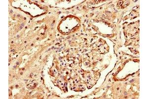 Immunohistochemistry of paraffin-embedded human kidney tissue using ABIN7167652 at dilution of 1:100 (Raptor anticorps  (AA 13-128))