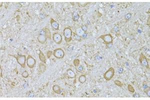 Immunohistochemistry of paraffin-embedded Mouse brain using MTNR1A Polyclonal Antibody at dilution of 1:100 (40x lens). (Melatonin Receptor 1A anticorps)