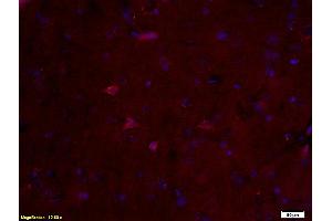 Formalin-fixed and paraffin embedded rat brain labeled with Anti-S100B Polyclonal Antibody, Unconjugated (ABIN676703) at 1:200 followed by conjugation to the secondary antibody and DAB staining. (S100B anticorps  (AA 31-92))