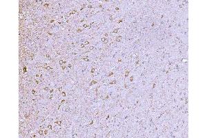 IHC analysis of CLASP1 using anti-CLASP1 antibody (ABIN7599144). (CLASP1 anticorps  (AA 1-243))