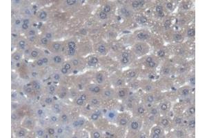 DAB staining on IHC-P; Samples: Mouse Liver Tissue (AGXT anticorps  (AA 120-334))
