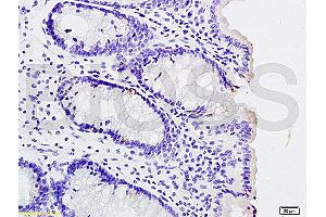 Formalin-fixed and paraffin embedded rat colitis labeled with Rabbit Anti phospho-IL-1R1(Tyr496) Polyclonal Antibody, Unconjugated (ABIN801423) at 1:200 followed by conjugation to the secondary antibody and DAB staining (IL1R1 anticorps  (pTyr496))