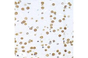 Immunohistochemistry of paraffin-embedded rat brain using KHDRBS1 antibody.