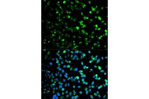 Immunofluorescence analysis of HeLa cell using TYMP antibody. (Thymidine Phosphorylase anticorps)