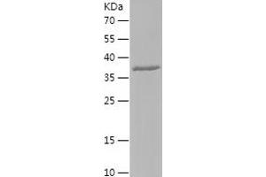 Western Blotting (WB) image for Hyaluronidase-2 (HYAL2) (AA 295-448) protein (His-IF2DI Tag) (ABIN7123374)