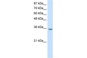 Western Blotting (WB) image for anti-Homeobox D4 (HOXD4) antibody (ABIN2461853) (HOXD4 anticorps)
