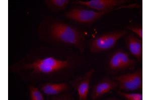 Immunofluorescence (IF) image for anti-Nuclear Factor of kappa Light Polypeptide Gene Enhancer in B-Cells 2 (NFKB2) (pSer870) antibody (ABIN1870475) (NFKB2 anticorps  (pSer870))