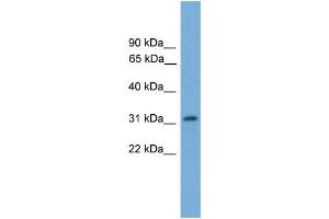 WB Suggested Anti-PIGL  Antibody Titration: 0. (PIGL anticorps  (N-Term))