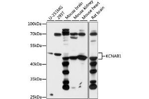 Western blot analysis of extracts of various cell lines, using KCN antibody (ABIN7269480) at 1:1000 dilution. (KCNAB1 anticorps  (AA 282-401))