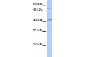 WB Suggested Anti-SOX4 Antibody Titration:  1 ug/ml  Positive Control:  Hela cell lysate