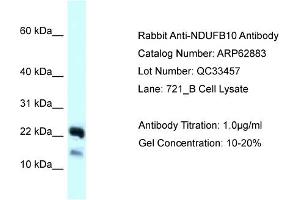 Western Blotting (WB) image for anti-NADH Dehydrogenase (Ubiquinone) 1 beta Subcomplex, 10, 22kDa (NDUFB10) (C-Term) antibody (ABIN2789283) (NDUFB10 anticorps  (C-Term))