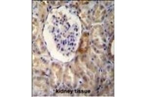 NR3C1 Antibody (C-term) B immunohistochemistry analysis in formalin fixed and paraffin embedded human kidney tissue followed by peroxidase conjugation of the secondary antibody and DAB staining. (Glucocorticoid Receptor anticorps  (C-Term))