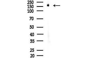 anti-Breakpoint Cluster Region (BCR) (N-Term) antibody