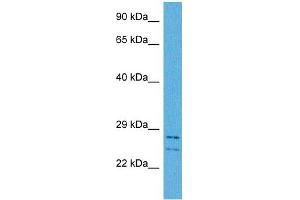 Host:  Rabbit  Target Name:  CSRP3  Sample Tissue:  Human HCT116 Whole Cell  Antibody Dilution:  1ug/ml