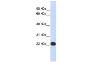 Image no. 1 for anti-Recoverin (RCVRN) (N-Term) antibody (ABIN6740369) (Recoverin anticorps  (N-Term))