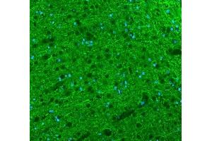 IF analysis of Alpha Internexin using anti-Alpha Internexin antibody (ABIN4886634).