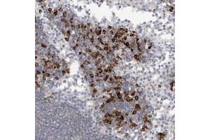 Immunohistochemical staining of human lymph node with TMEM69 polyclonal antibody  shows strong cytoplasmic positivity in lymphoid cells outside reaction centra at 1:20-1:50 dilution. (TMEM69 anticorps)