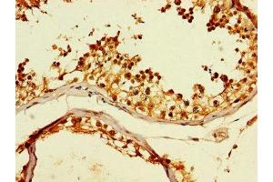 Immunohistochemistry of paraffin-embedded human testis tissue using ABIN7171428 at dilution of 1:100