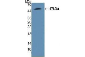 Detection of Recombinant ASS1, Human using Polyclonal Antibody to Argininosuccinate Synthetase 1 (ASS1) (ASS1 anticorps  (AA 1-412))