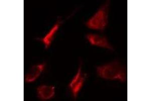 ABIN6275267 staining HeLa cells by IF/ICC. (MYO5A anticorps  (C-Term))