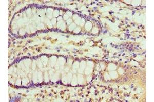 Immunohistochemistry of paraffin-embedded human colon tissue using ABIN7151115 at dilution of 1:100 (RBX1 anticorps  (AA 1-108))