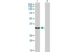 Western Blot analysis of SSR1 expression in transfected 293T cell line by SSR1 monoclonal antibody (M02), clone 1C11. (SSR1 anticorps  (AA 33-286))