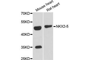 Western blot analysis of extracts of various cell lines, using NKX2-5 antibody (ABIN6293408) at 1:3000 dilution. (NK2 Homeobox 5 anticorps)