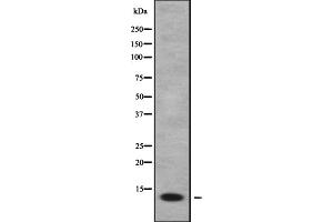 Western blot analysis FDCSP using HepG2 whole cell lysates