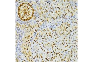 Immunohistochemistry of paraffin-embedded rat ovary using ALYREF antibody. (THO Complex 4 anticorps)