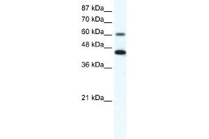 WB Suggested Anti-ANXA6 Antibody Titration:  1. (ANXA6 anticorps  (N-Term))