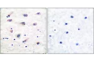 Immunohistochemistry analysis of paraffin-embedded human brain, using PLCB3 (Phospho-Ser1105) Antibody. (PLCB3 anticorps  (pSer1105))