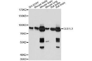 Western blot analysis of extracts of various cell lines, using GLB1L3 antibody. (GLB1L3 anticorps)