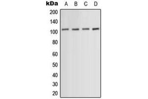 Western blot analysis of ACTN1/2/3/4 expression in HeLa (A), HuvEc (B), mouse muscle (C), PC12 (D) whole cell lysates. (ACTN1/2/3/4 anticorps  (N-Term))