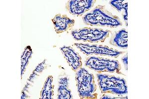 IHC analysis of MUC13 using anti-MUC13 antibody (ABIN6719597). (MUC13 anticorps  (AA 226-312))