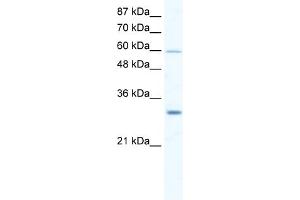 WB Suggested Anti-DDX31 Antibody Titration:  2. (DDX31 anticorps  (N-Term))