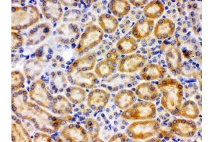 Anti-CYP27B1 Picoband antibody, IHC(P) IHC(P): Rat Kidney Tissue (CYP27B1 anticorps  (C-Term))