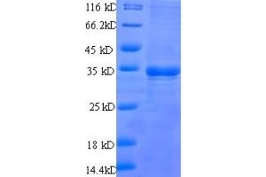 SDS-PAGE (SDS) image for Prostate Stem Cell Antigen (PSCA) (AA 21-95) protein (GST tag) (ABIN5710165)
