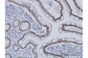 Immunoperoxidase of monoclonal antibody to TCF7L2 on formalin-fixed paraffin-embedded human small Intestine.