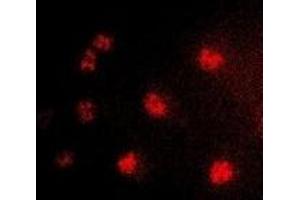 Immunofluorescent analysis of TLX staining in HepG2 cells. (NR2E1 anticorps)