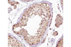 ABIN6267381 at 1/200 staining human testis tissue sections by IHC-P. (BRAF anticorps  (pThr599))