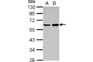 WB Image Sample (30 ug of whole cell lysate) A: A431 B: HeLa 10% SDS PAGE antibody diluted at 1:1000