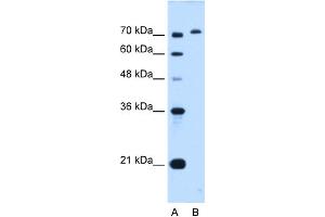 WB Suggested Anti-GPAA1 Antibody Titration:  0. (GPAA1 anticorps  (C-Term))