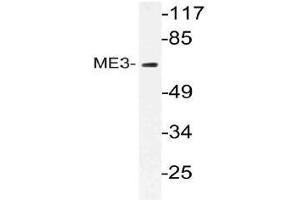 Western blot (WB) analysis of ME3 antibody in extracts from RAW264 cells. (ME3 anticorps)