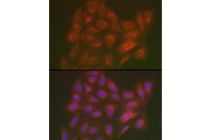 Immunofluorescence analysis of U2OS cells using LML Rabbit pAb (ABIN7268204) at dilution of 1:250 (40x lens). (LMAN2L anticorps)